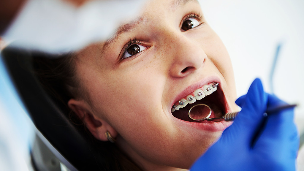 Conheça os benefícios do tratamento ortodôntico na fase adulta - Ponte São  João Odontologia Estética